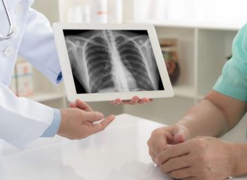 Par atbalstu, informāciju un atgādinājumu drošības pasākumu ievērošanai tuberkulozes ierobežošanas aspektā